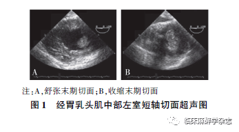 心动图|经食管超声心动图在非心脏手术中应用专家共识 （2020版）