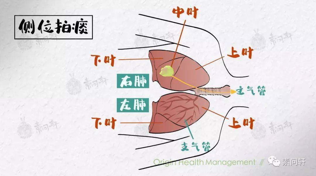 痰的原理是什么_肺癌的血痰是什么颜色