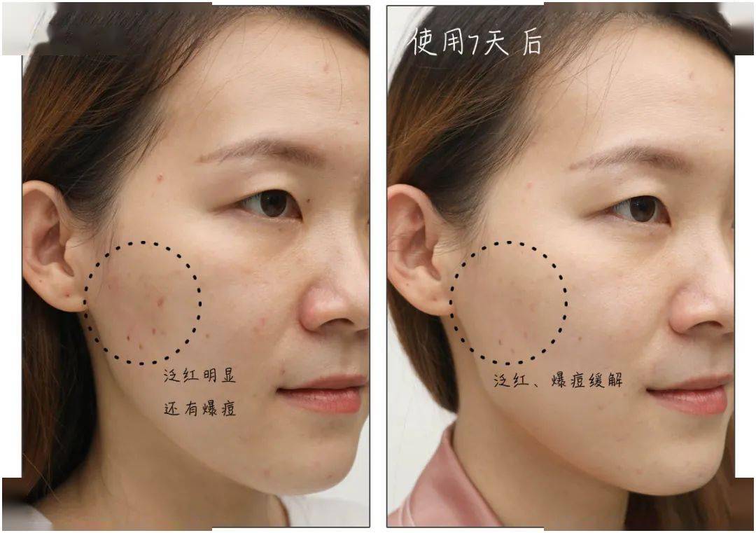 小粉|双11系列清单 | 读者说：别的可以不买，这件单品我一定要入！（上篇）