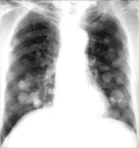 怎么养肺最简单的方法 6363ed8e2d8d4eceab1828b4a1f7ae73.jpeg