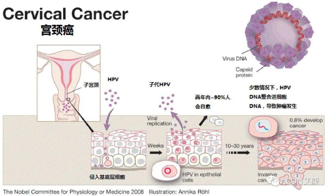 关于hpv疫苗5大疑问_手机搜狐网