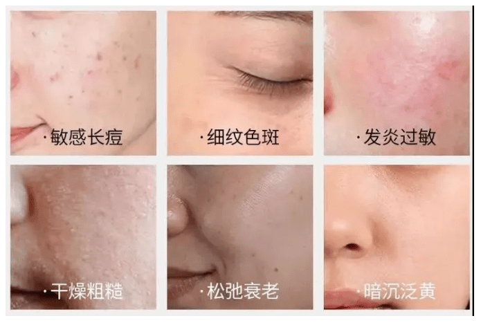 ta|十斤黑芝麻都比上2颗ta！风靡美国的这颗糖把头发越吃越密，皮肤也变好了，感觉年轻10多岁！