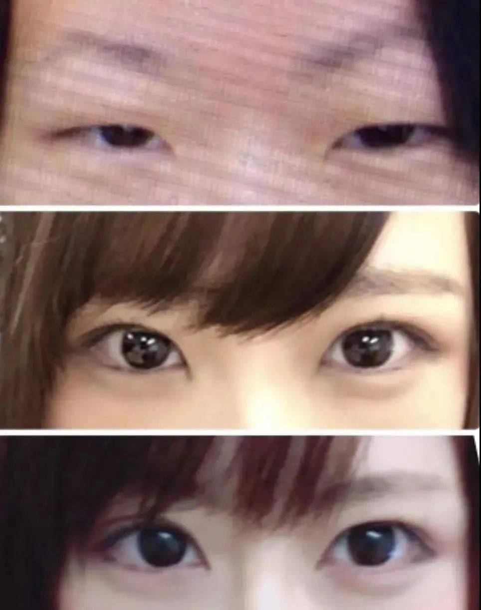 太丑|因被diss“太丑”花400万整容，宅女逆袭成新垣结衣？