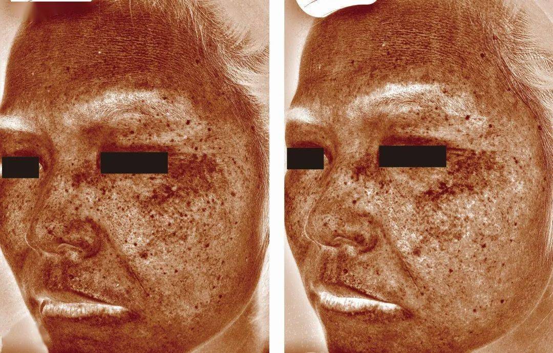 肌肤|嫩到掐出水！用一次比敷100片面膜还白润，10分钟感受女星同款水光肌！