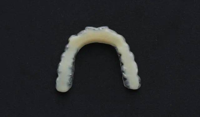 盘点磨牙垫用于治疗磨牙症的各种口内咬合板