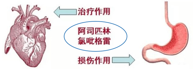 服用阿司匹林和氯吡格雷如何预防胃肠道出血