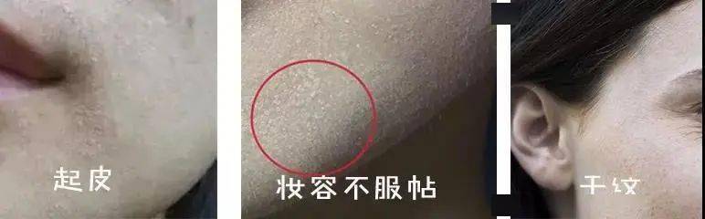 贵妇|100元出头入手韩雪同款“贵妇级”抚纹抗皱精华？原来“液体超声刀”是这种感觉......