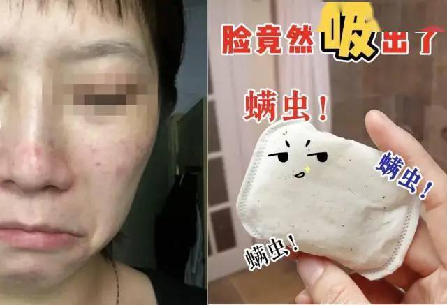 肌肤|洗脸10次不如用它一次？亲眼看脏东西往外排，毛孔没垃圾，年轻又显白