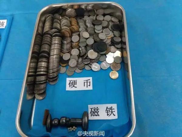 家长|家长一个月后才送医,结果…1岁男婴吞了8颗磁力珠