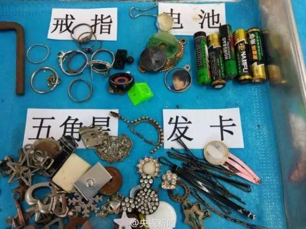 家长|家长一个月后才送医,结果…1岁男婴吞了8颗磁力珠