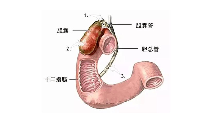 【中医健康】胆囊疾病患者需警惕些什么?