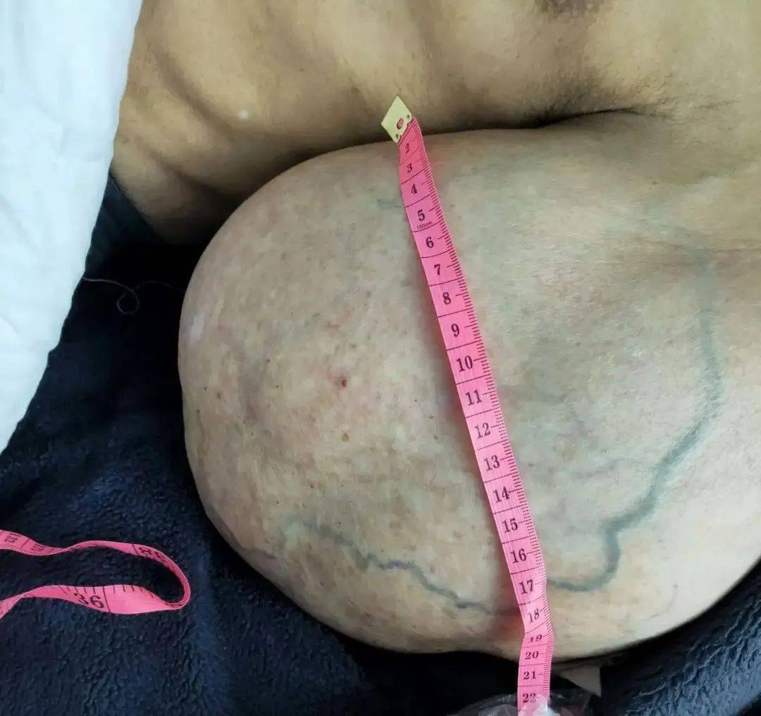 疱疹用什么抗病毒的药 80877a5e0df940779306b10fb13d26ac.jpeg