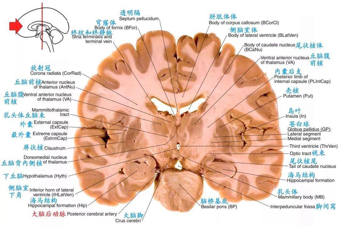 解剖| 颅脑断层解剖图谱~标注到位,值得收藏