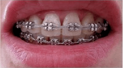 牙齿|出道前do了这里，现在的她也太惊艳了吧！