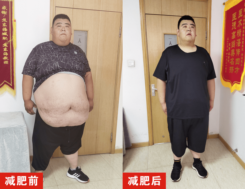 辽宁都市频道《新闻正前方》跟踪报道:430斤小伙累计减肥100天 甩掉