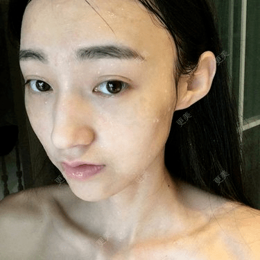 皮肤|杨幂早期合照见心机？看完原图呆了，她们这么早竟都整了...