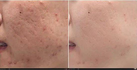 情敌|亚洲第一“鲜肉收割机”， 53岁生图曝光，成三亿女人情敌：这是什么人间尤物…