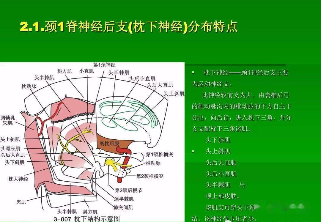 脊神经后支卡压综合征的诊断与微创针刀治疗