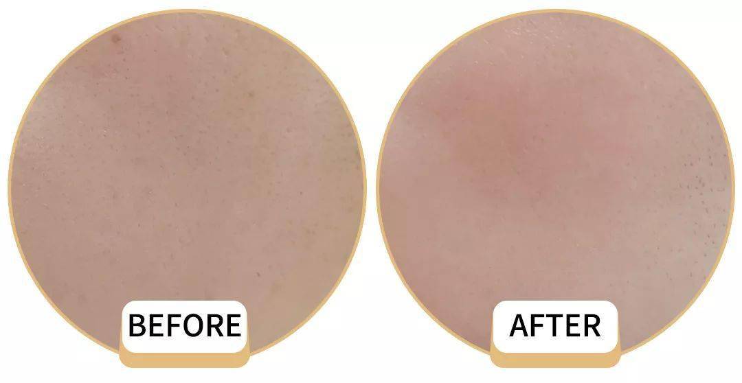 怎样才能不卡粉不起皮 f66414bccfcb4316bfc205cf3a4e87bb.jpeg