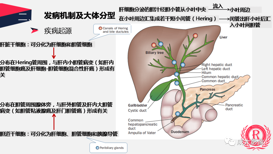 精彩课件丨胆管细胞癌影像与临床