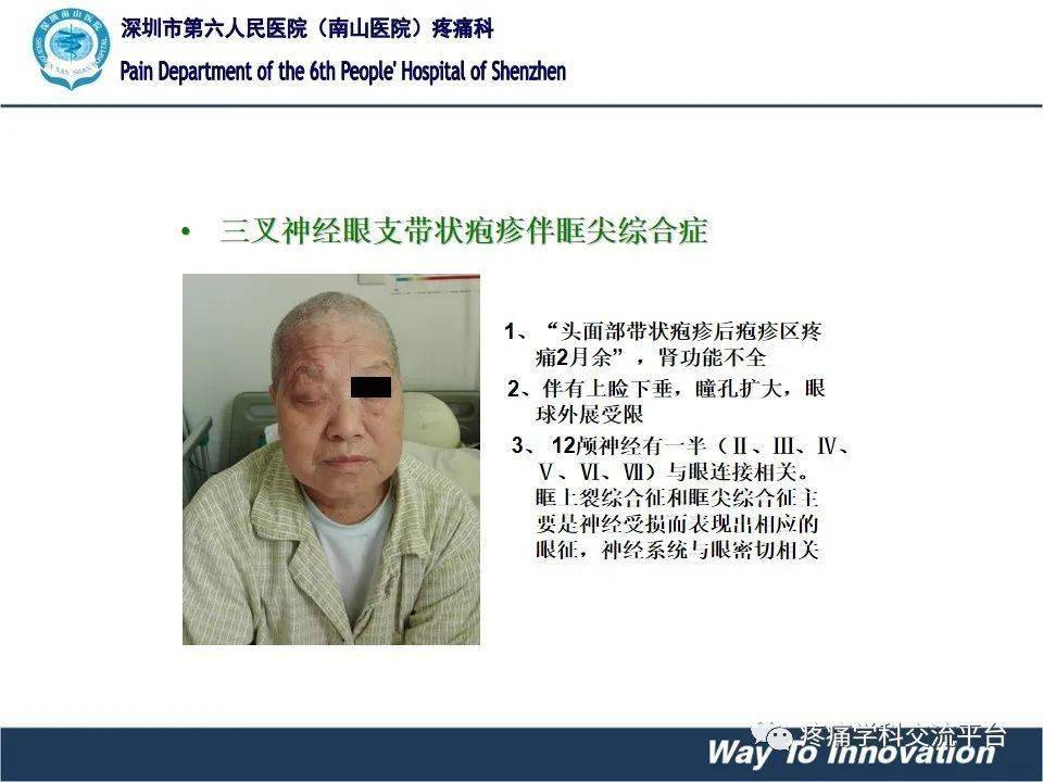 带状疱疹是什么原因引起神经疼 382c4044e24340f58e35992e44d1fb97.jpeg
