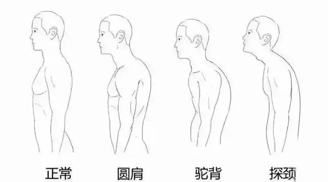 团弯腰驼背请用日本知名品牌ikedaya池田屋让背更挺拔