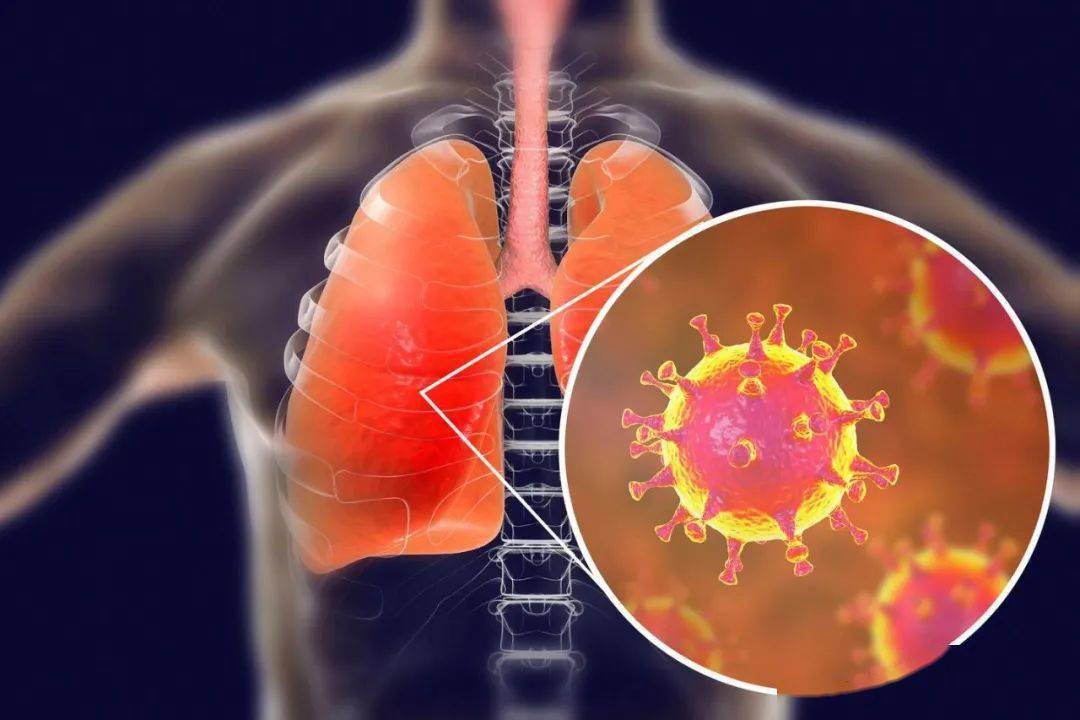 全中国有多少新冠装扁桃病毒人口_新冠病毒图片