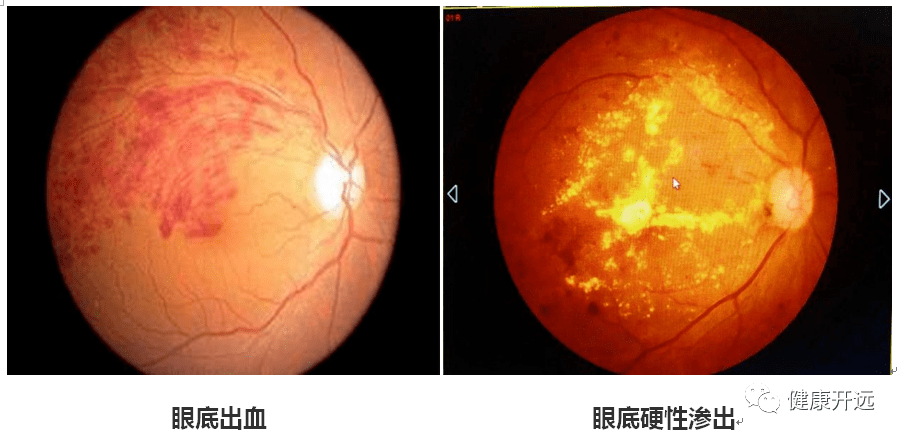 除了自拍,您该给眼底照相了