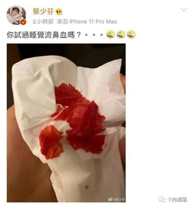 蔡少芬深夜发染满鲜血纸巾照,吓坏网民:保重身体!