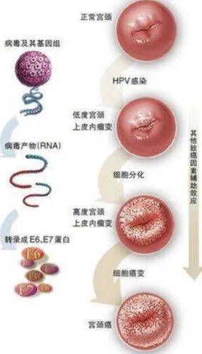 南医说 | hpv疫苗保护期多长?男人也要打吗?"价"越高越好吗?