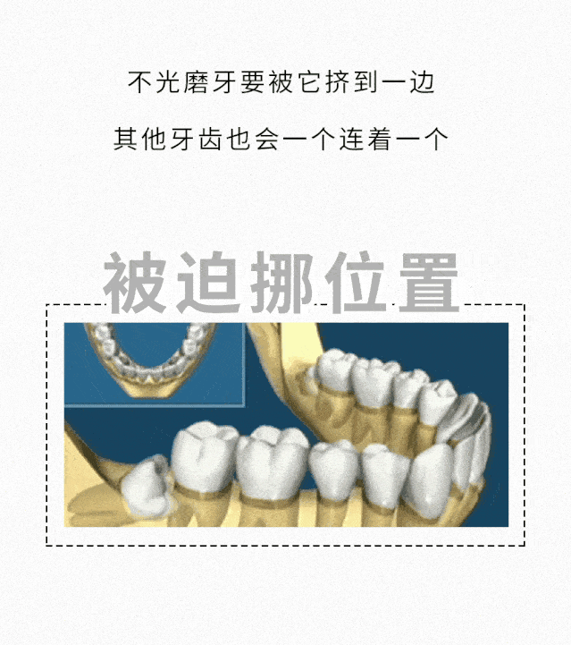 只因一颗小小的智齿,准妈妈及腹中胎儿险丧命!