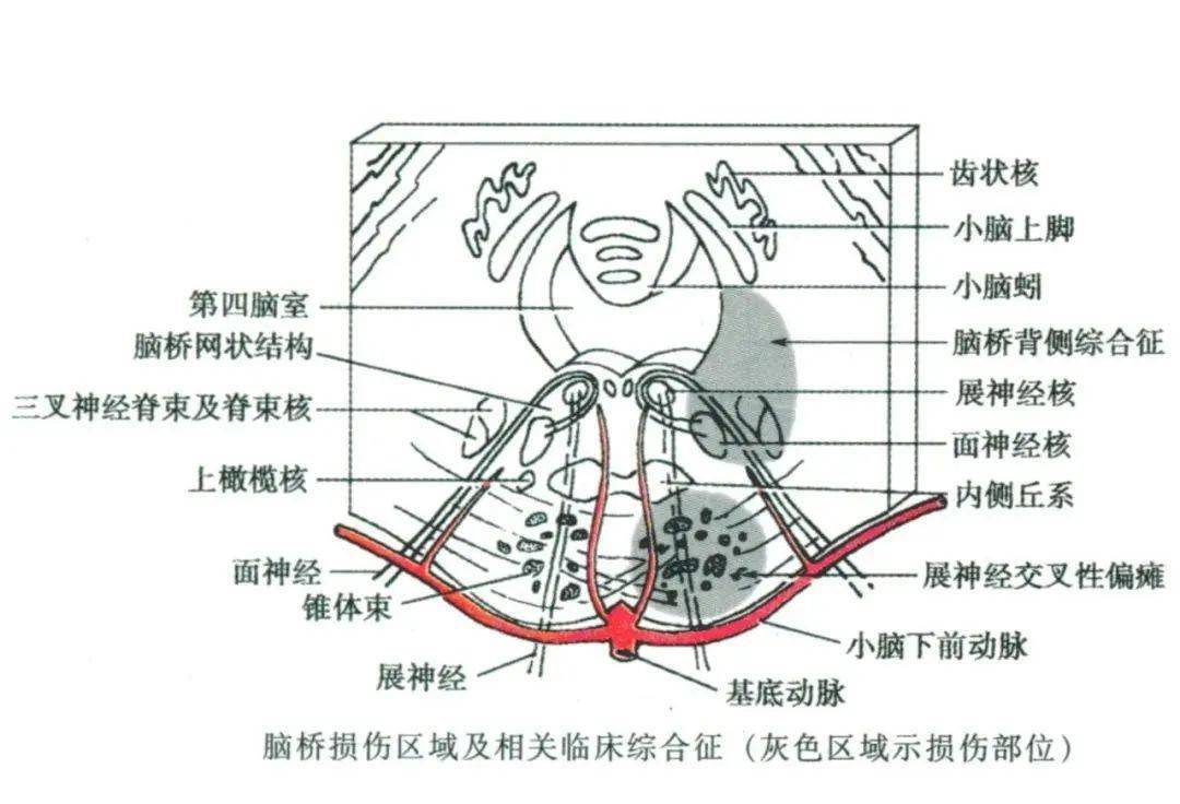 【收藏】脑干内部超详细功能解剖图