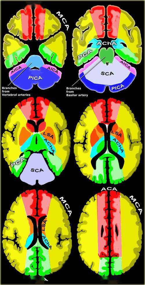 脑动脉供血区域图