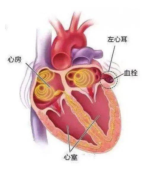 中大频道捂住心脏的耳朵预防脑中风