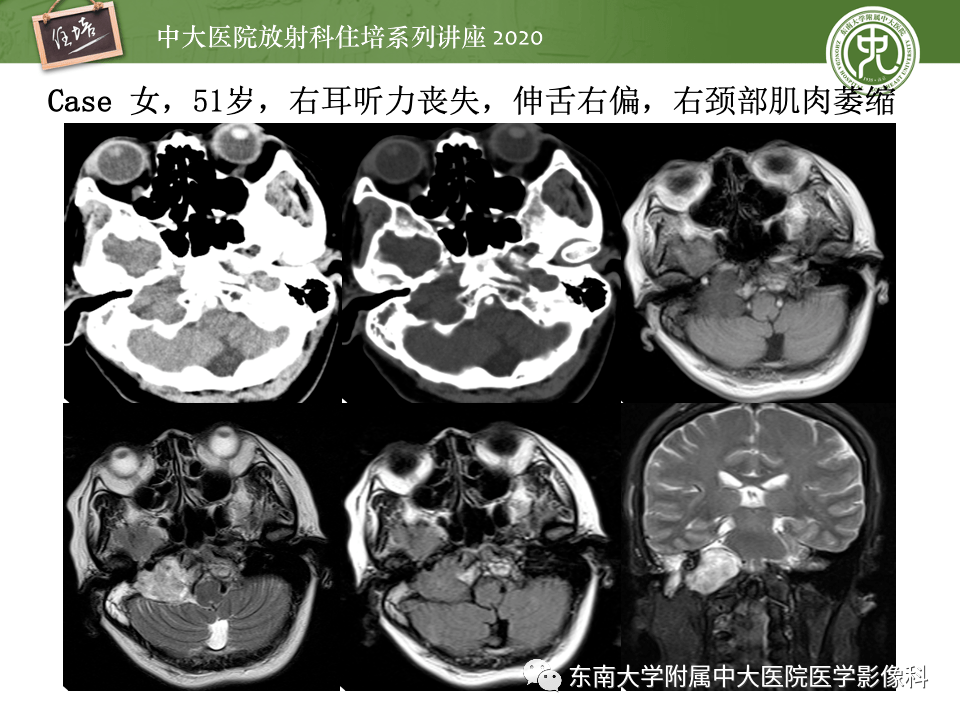 ae1464f618a240cb9a1104cfda727488.png