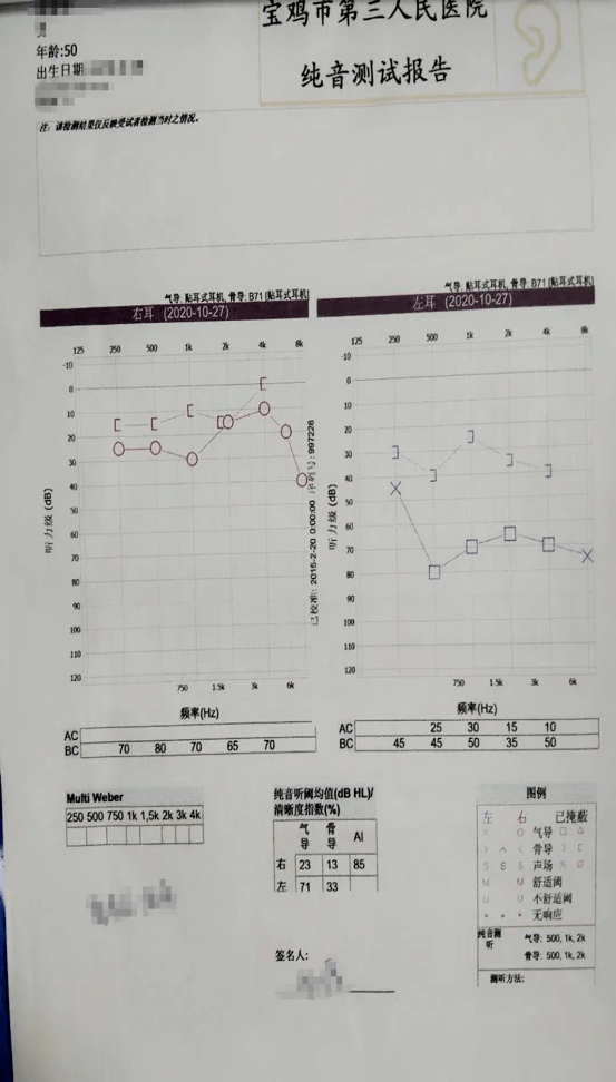 李女士的神经性耳聋,属于比较典型的一种,经常性的熬夜会导致睡眠不