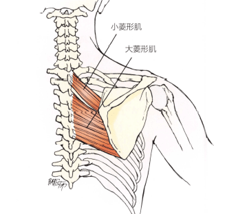 横向松解菱形肌用拇指支撑技术从内侧往外推,以松解棘突旁的软组织(3)