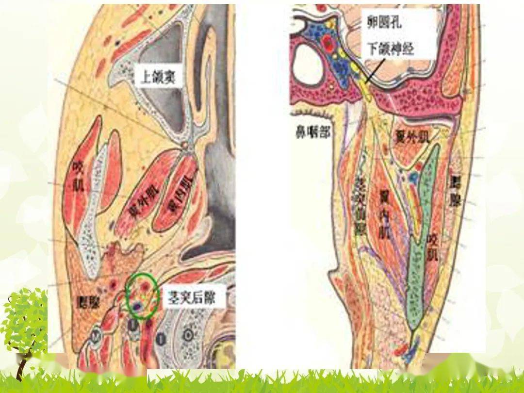 咽旁间隙解剖及常见病变影像表现