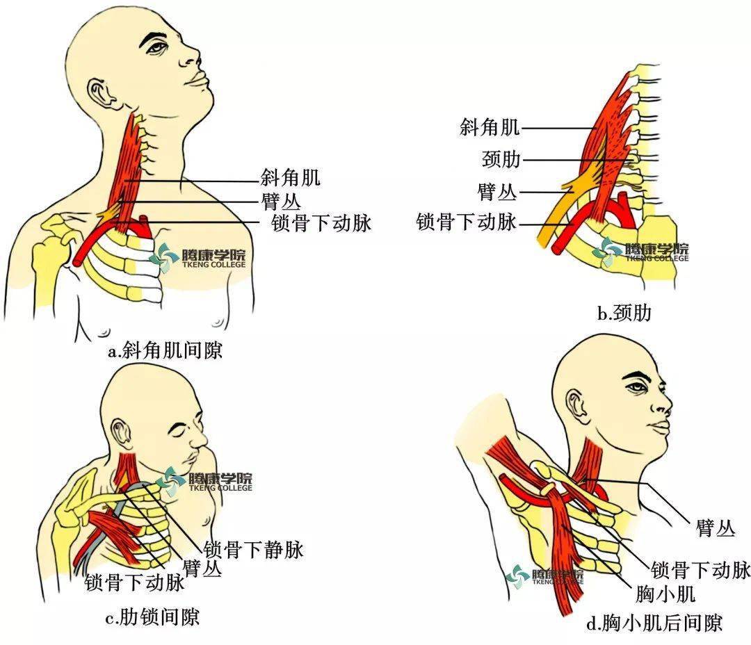 应用解剖 胸廓出口是指从颈椎及纵隔上缘延伸至胸小肌外侧缘,由第1