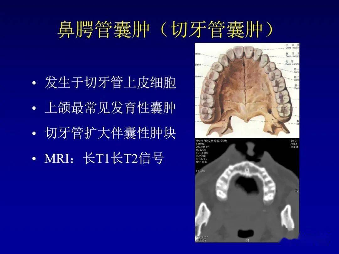 颌面部解剖及其病变的影像诊断