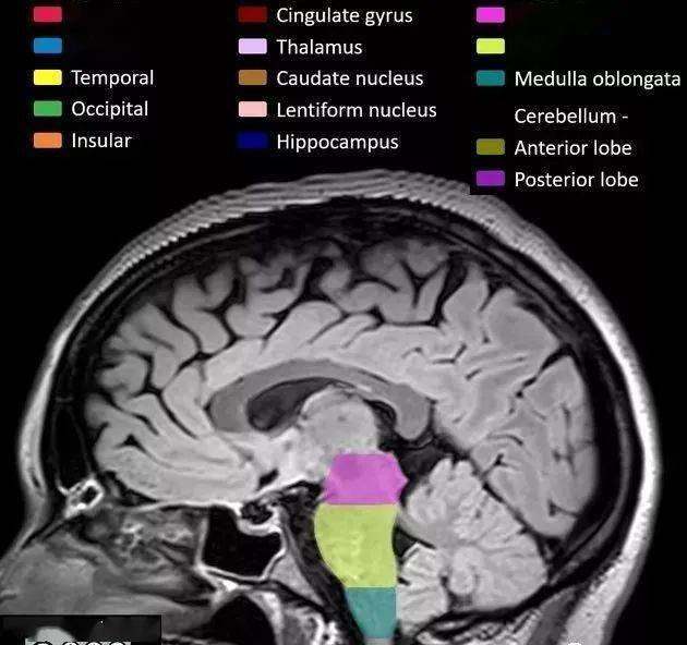 cingulate, insular 岛叶 cingulate gyrus 扣带回 thalamus 丘脑 caudate