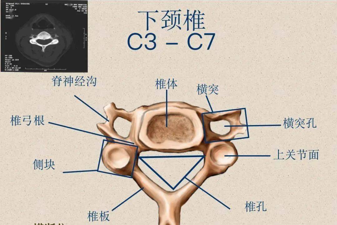 下颈椎(c3~c7):棘突 (分叉)关节面侧块,较大横突——横突孔,椎动脉