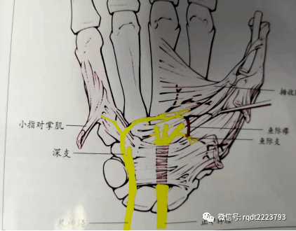 肌腱的耐受压力相对较强,神经比较娇嫩对受压比较敏感,腕管内空间的