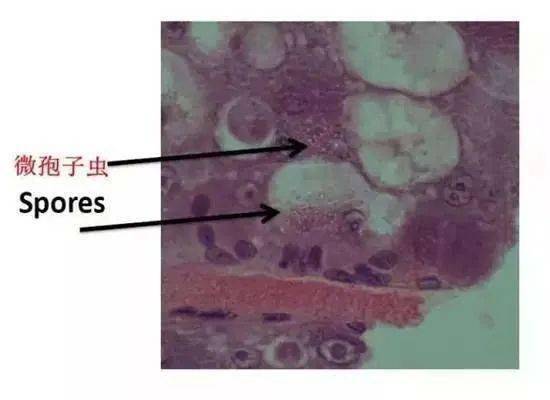 肝肠胞虫让虾农们损失百万感染虾肝肠孢虫的虾塘应该怎么做