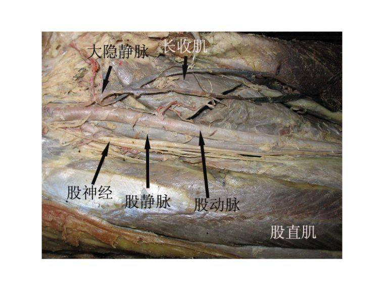 疼痛科专业人体解剖详解