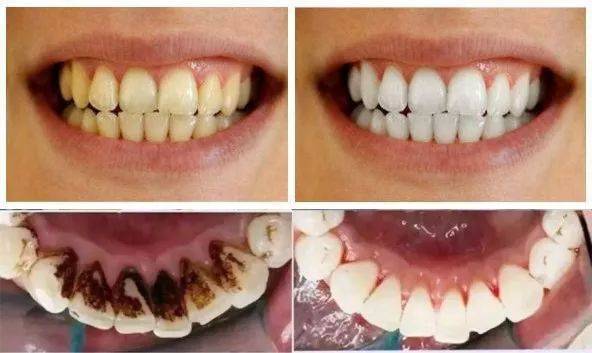 有效杀死大肠杆菌,沙门氏菌等有害菌