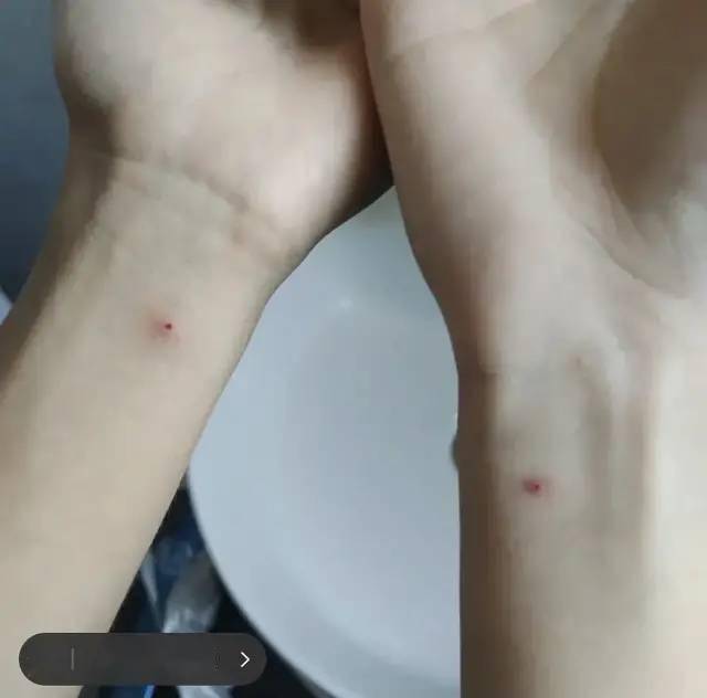 有人(胡)说,在手臂同样的位置上刺上  "朱砂痣",下辈子能与爱人再次