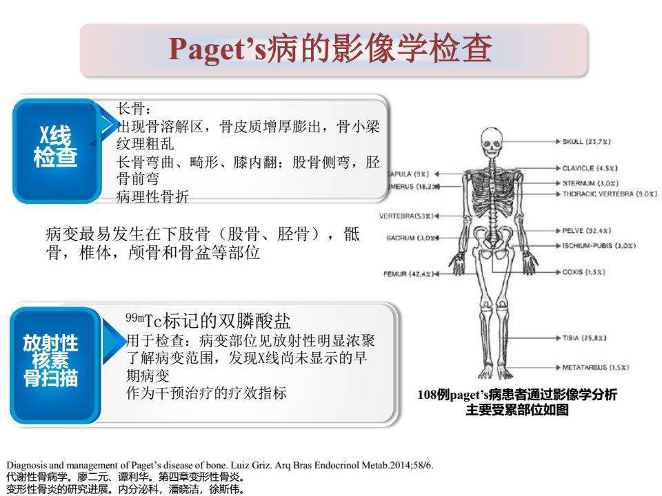 一文搞定 | paget骨病诊治详解