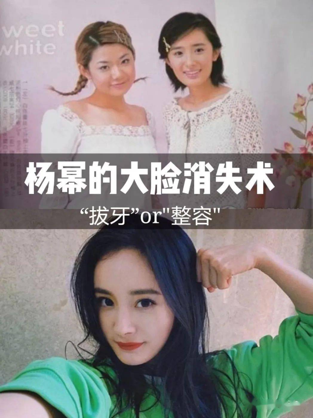 杨幂"逆天改命"是靠整容还是拔牙将大方脸变成小v脸的?