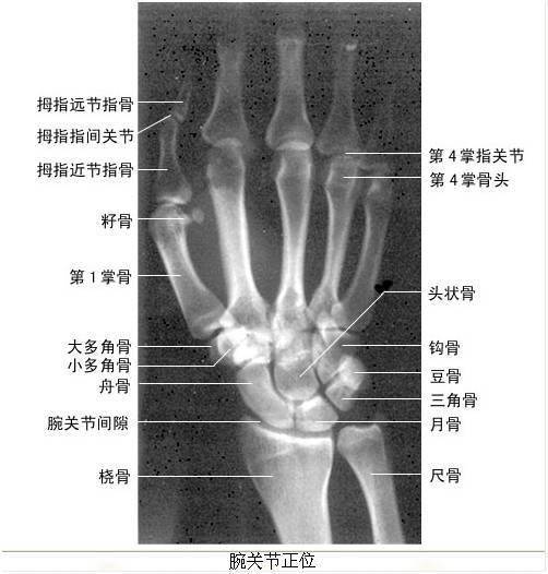 医学常识丨全身x线解剖_手机搜狐网